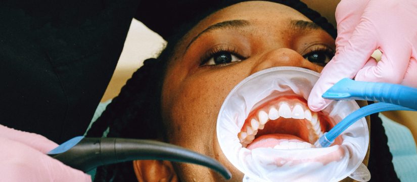 Full mouth rehabilitation