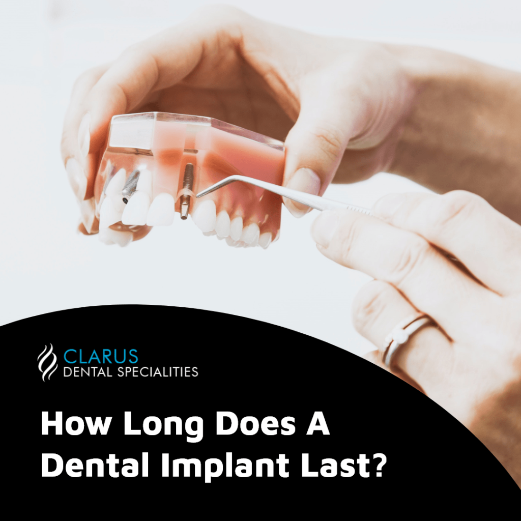 How long does a dental implant last