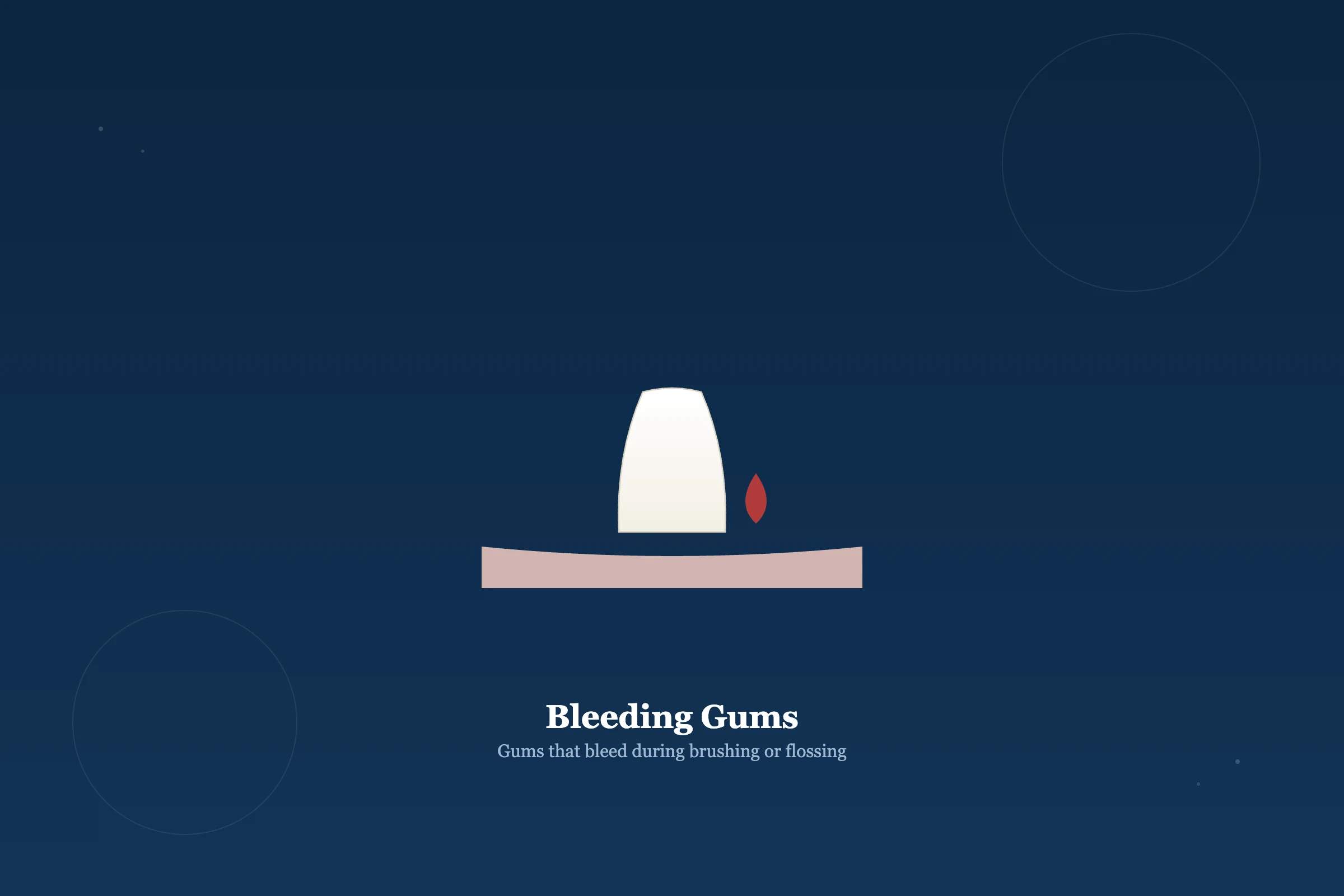 Bleeding Gums at Clarus Dental Specialities, Koregaon Park, Pune