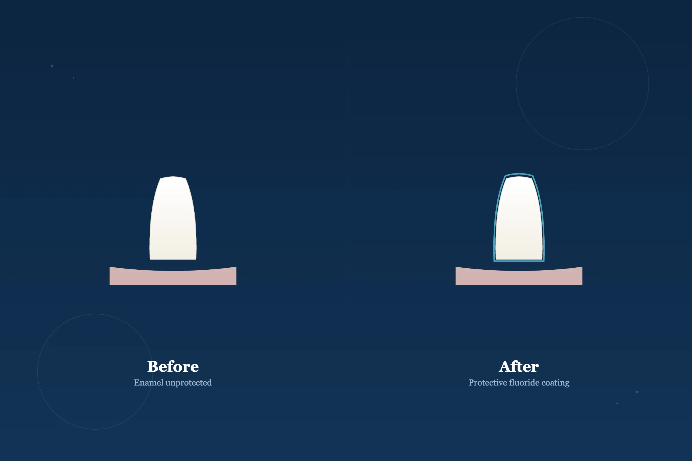 Fluoride Treatment at Clarus Dental Specialities, Koregaon Park, Pune